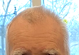 Lead photo