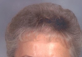 Lead photo