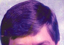 Lead photo